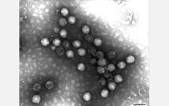 Transmission electron micrograph showing adenoviruses.