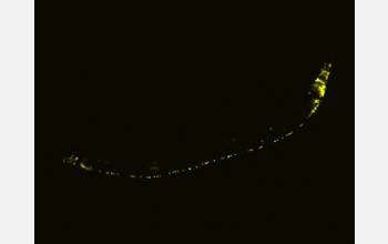 Photo of C. elegans under yellow florescence.