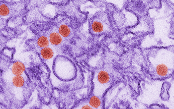 Transmission electron micrograph (TEM) of the Zika virus.