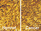AFM cell surface adhesion map of bladder cells