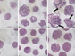 embryoid body impaired differentiation