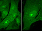 fibroblast cells