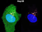 a greenly fluoresced cancerous liver cell