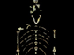 Lucy, a 3.18 million year old fossil specimen