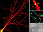 lysosomes identified in dendrites and dendritic spines using various techniques