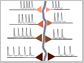 a neuron with a tree trunk-like dendrite