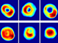 healthy red blood cells (top row) and malaria infected cells (bottom row)