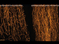 microtubules in heart cells from a healthy patient (left) and from a patient with heart failure