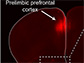 florescent cells in the prelimbic prefrontal cortex brain region