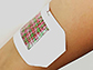 smart bandage