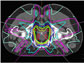 News thumbnail of radiation planning algorithm