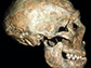 skull of a Neandertal known as Shanidar 1