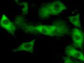 Smad4 glow in the dark nuclei of the cells