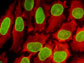 two biomarkers are stained green and red