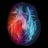 Brain visualization