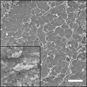scanning electron micrographs of Raney-NiSn catalyst