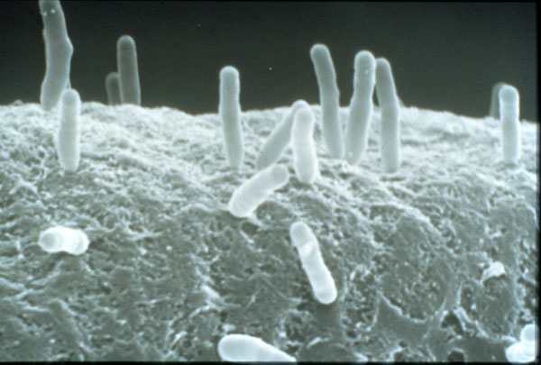 The Agrobacterium tumefaciens microbe
